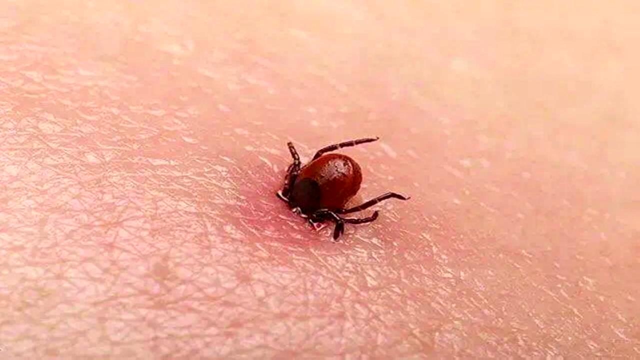 新型布尼亚病毒，感染后几天内可致命？了解真相与防护之道