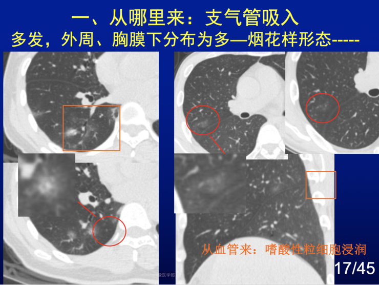 当基础病遇上新冠肺炎，双重风险下的生命防线