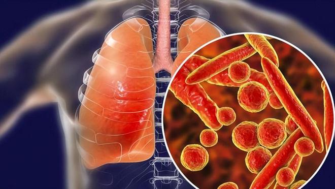 新冠肺炎症状的早期表现为，警惕这些身体信号