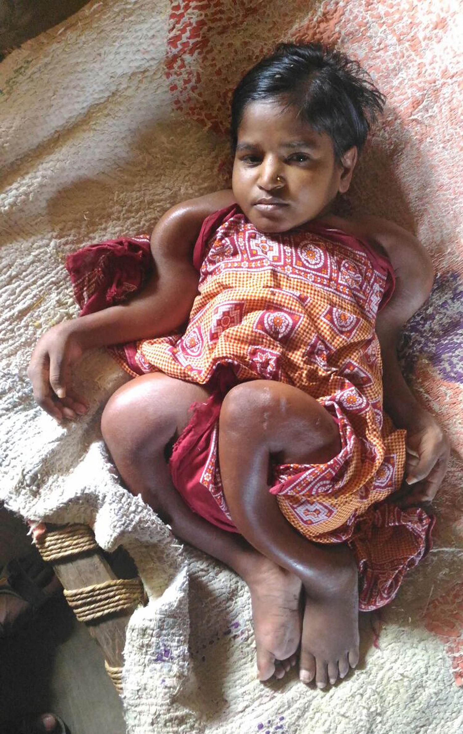 印度变异株席卷全球，知乎网友如何解读疫情新变数？