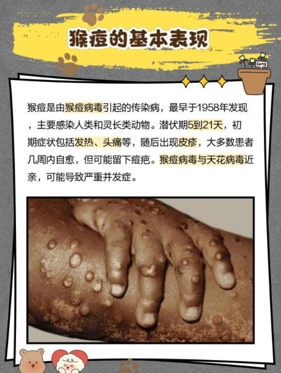 沈阳猴痘患者在哪里治疗，权威指南与防控措施