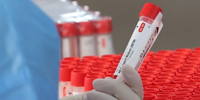 重组毒株XE闪现，我们应该担心什么？