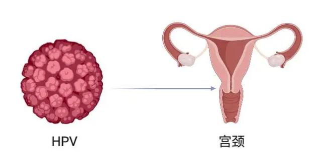 当HPV再次阳性，这不是简单的复发，而是健康的再次提醒
