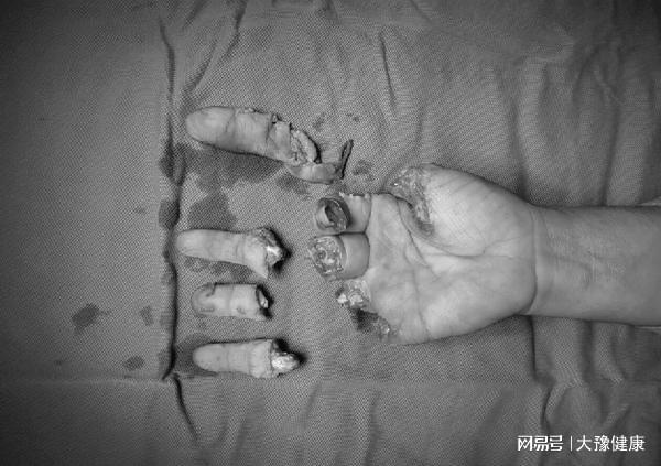 都市暗影，上海断指事件背后的遣送之痛