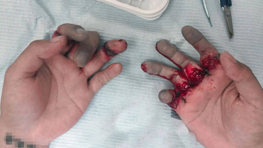 都市暗影，上海断指事件背后的遣送之痛